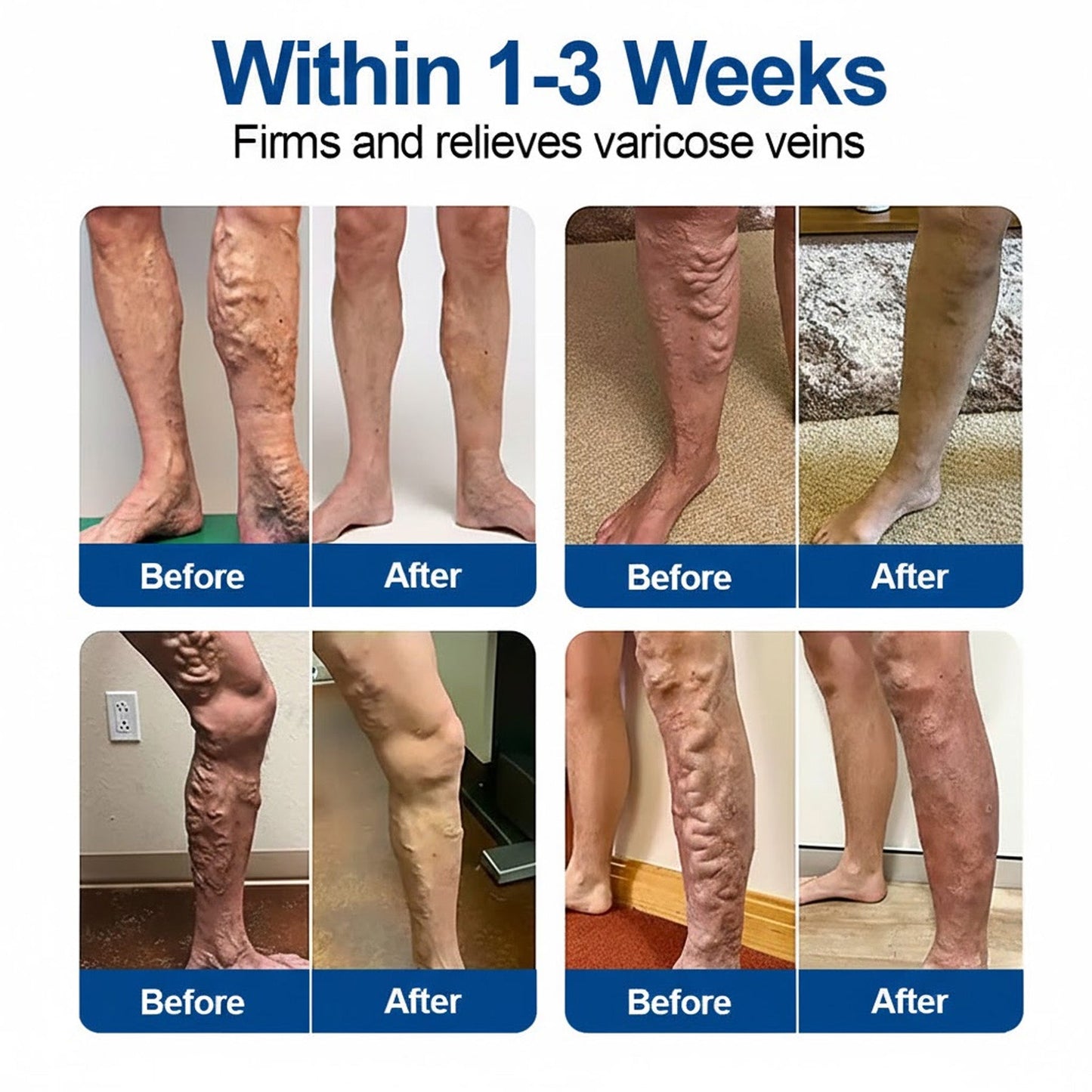 🇺🇸👨‍⚕️✅ Medistart®  VeinRepair Microneedle Care Patch⚡Instant Relief, Long-Term Results