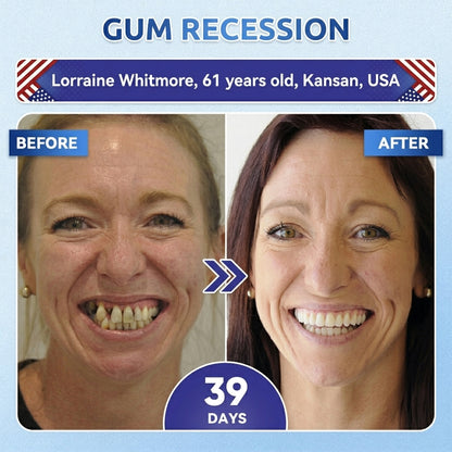🦷PuraCure® Multi-Action Tooth & Gum Repair Mouthwash  | Collagen × Postbiotics × β-Glucanase