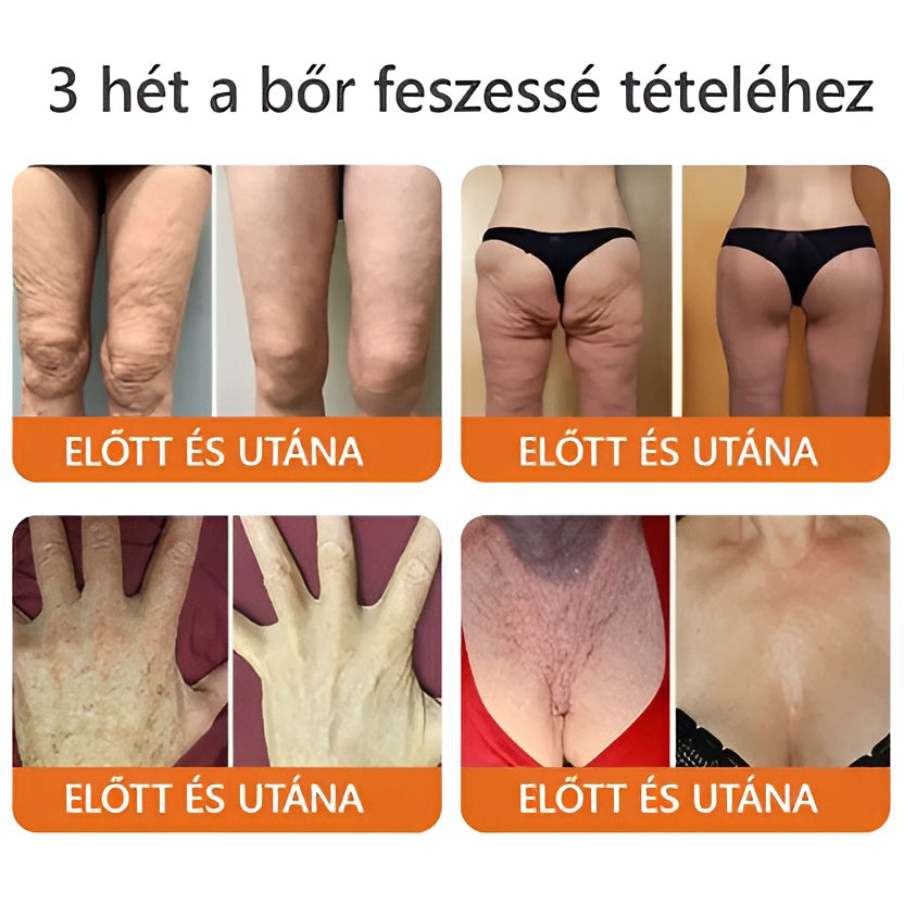 📦 Bőrgyógyász ajánlása ✨ ZödVita® Méhméreg Bőr Helyreállító Krém 🔥 Magyar fejlesztés, magyarországi gyártás és szállítás