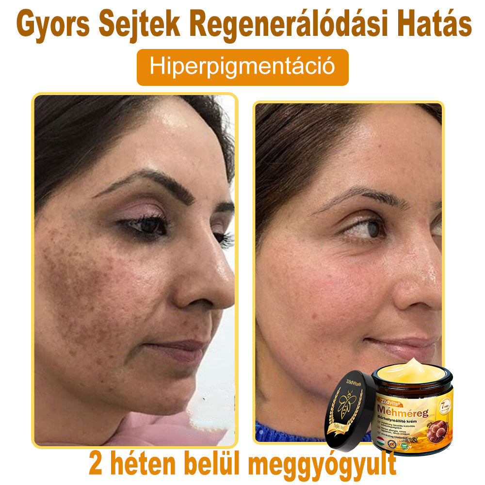 📦 Bőrgyógyász ajánlása ✨ ZödVita® Méhméreg Bőr Helyreállító Krém 🔥 Magyar fejlesztés, magyarországi gyártás és szállítás