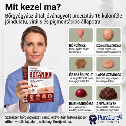 𝐏𝐔𝐑𝐀𝐂𝐔𝐑𝐄® 𝐌𝐈𝐊𝐑𝐎-𝐓Ű𝐒 𝐁𝐎𝐓𝐀𝐍𝐈𝐊𝐀𝐈 𝐁Ő𝐑𝐊𝐈𝐍Ö𝐕É𝐒-𝐄𝐋𝐓Á𝐕𝐎𝐋Í𝐓Ó 𝐓𝐀𝐏𝐀𝐒𝐙𝐎𝐊 —5 𝐍𝐀𝐏𝐎𝐒 𝐂É𝐋𝐙𝐎𝐓𝐓 𝐄𝐋𝐓Á𝐕𝐎𝐋Í𝐓Á𝐒 𝐁Ő𝐑𝐍𝐘Ú𝐋𝐕Á𝐍𝐘𝐎𝐊, 𝐒𝐙𝐄𝐌Ö𝐋𝐂𝐒Ö𝐊 É𝐒 𝐊𝐈𝐄𝐌𝐄𝐋𝐊𝐄𝐃Ő 𝐁Ő𝐑𝐇𝐈𝐁Á𝐊 𝐄𝐋𝐋𝐄𝐍