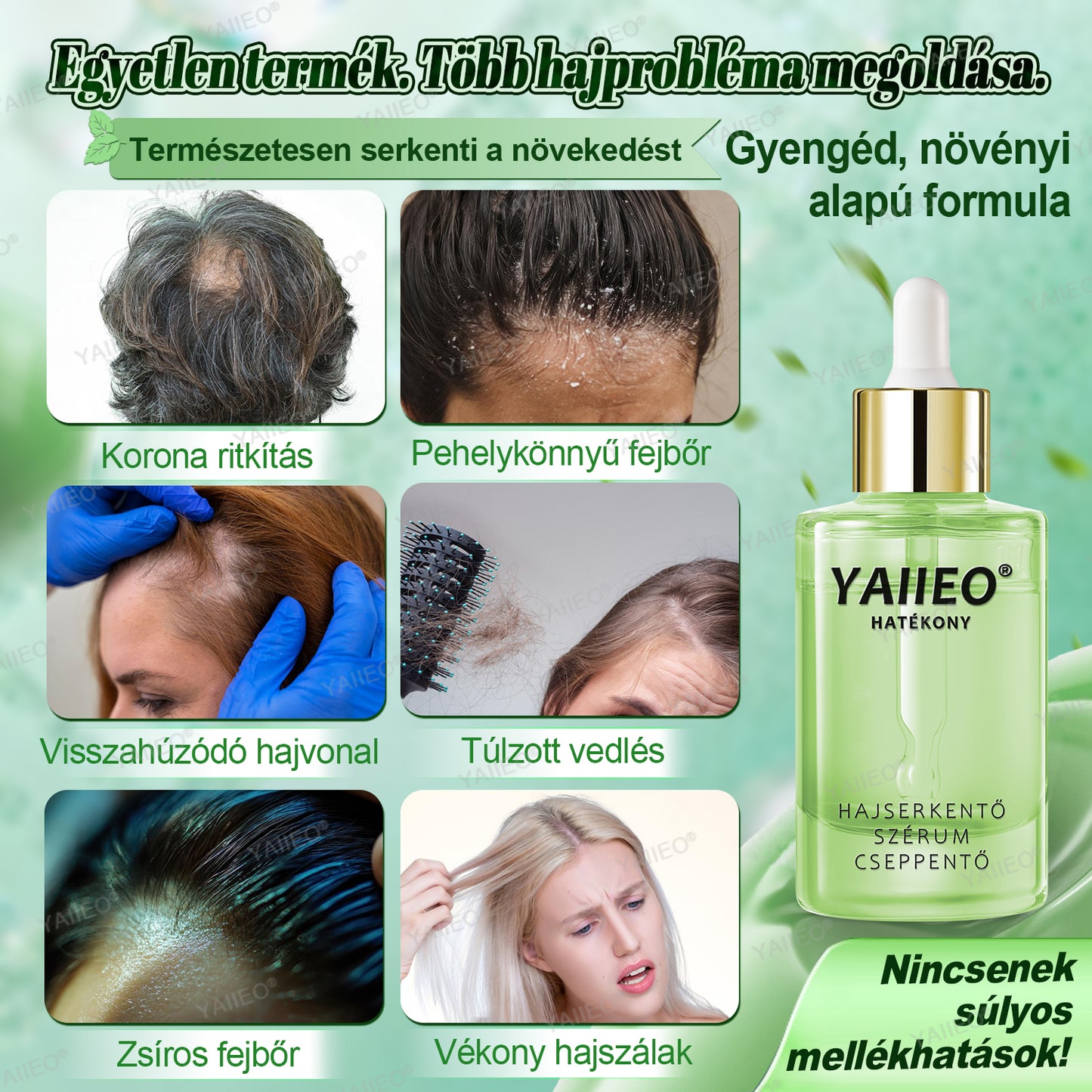 𝒀𝑨𝑰𝑰𝑬𝑶® 𝑯𝒂𝒋𝒔𝒆𝒓𝒌𝒆𝒏𝒕ő 𝑺𝒛é𝒓𝒖𝒎 – 𝑭á𝒋𝒅𝒂𝒍𝒐𝒎𝒎𝒆𝒏𝒕𝒆𝒔 𝑯𝒂𝒋á𝒑𝒐𝒍á𝒔