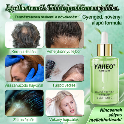 𝒀𝑨𝑰𝑰𝑬𝑶® 𝑯𝒂𝒋𝒔𝒆𝒓𝒌𝒆𝒏𝒕ő 𝑺𝒛é𝒓𝒖𝒎 – 𝑭á𝒋𝒅𝒂𝒍𝒐𝒎𝒎𝒆𝒏𝒕𝒆𝒔 𝑯𝒂𝒋á𝒑𝒐𝒍á𝒔