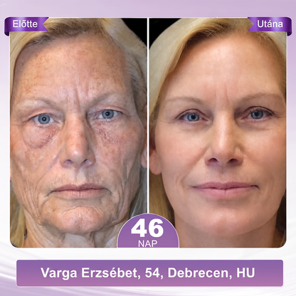 PuraCure® PDRN Multi-Peptid Masszírozó Testgörgős Krém – Öregedésgátlás, hidratálás, bőrfeszesítő és emelő hatás bőrjavítás, egyenletes bőrtónus, akne sötét foltok kezelése, szemölcsök és anyajegyek eltávolítása, valamint pikkelysömör enyhítése.