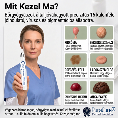 PuraCure® 👩‍⚕️ 7 Napos Bőrkinövés- és Anyajegyápoló Roller – Fájdalommentes, Hegmentes Bőrhibák Ellen