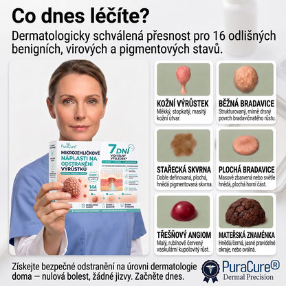 PuraCure® MIKROJEHLIČKOVÉ NÁPLASTI PRO ODSTRANĚNÍ KOŽNÍCH VÝRŮSTKŮ —— 7DENNÍ CÍLENÁ PÉČE PRO KOŽNÍ VÝRŮSTKY, BRADAVICE A VYSTOUPLÉ NEDOKONALOSTI POKOŽKY