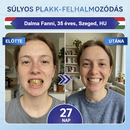 🦷PuraCure® többhatású fog- és ínyregeneráló szájvíz | Kollagén × posztbiotikumok × β-glükanáz