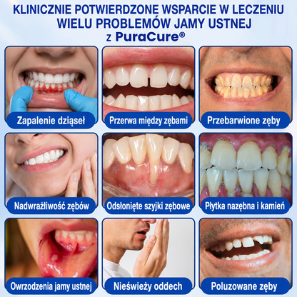 🇵🇱👨‍⚕️✅🦷𝗣𝘂𝗿𝗮𝗖𝘂𝗿𝗲® 𝗢𝗗𝗡𝗢𝗪𝗔 𝗗𝗭𝗜Ą𝗦𝗘Ł Ż𝗲𝗹 𝗻𝗮𝗽𝗿𝗮𝘄𝗰𝘇𝘆 𝗽𝗿𝘇𝘆 𝗽𝗮𝗿𝗮𝗱𝗼𝗻𝘁𝗼𝘇𝗶𝗲🍔