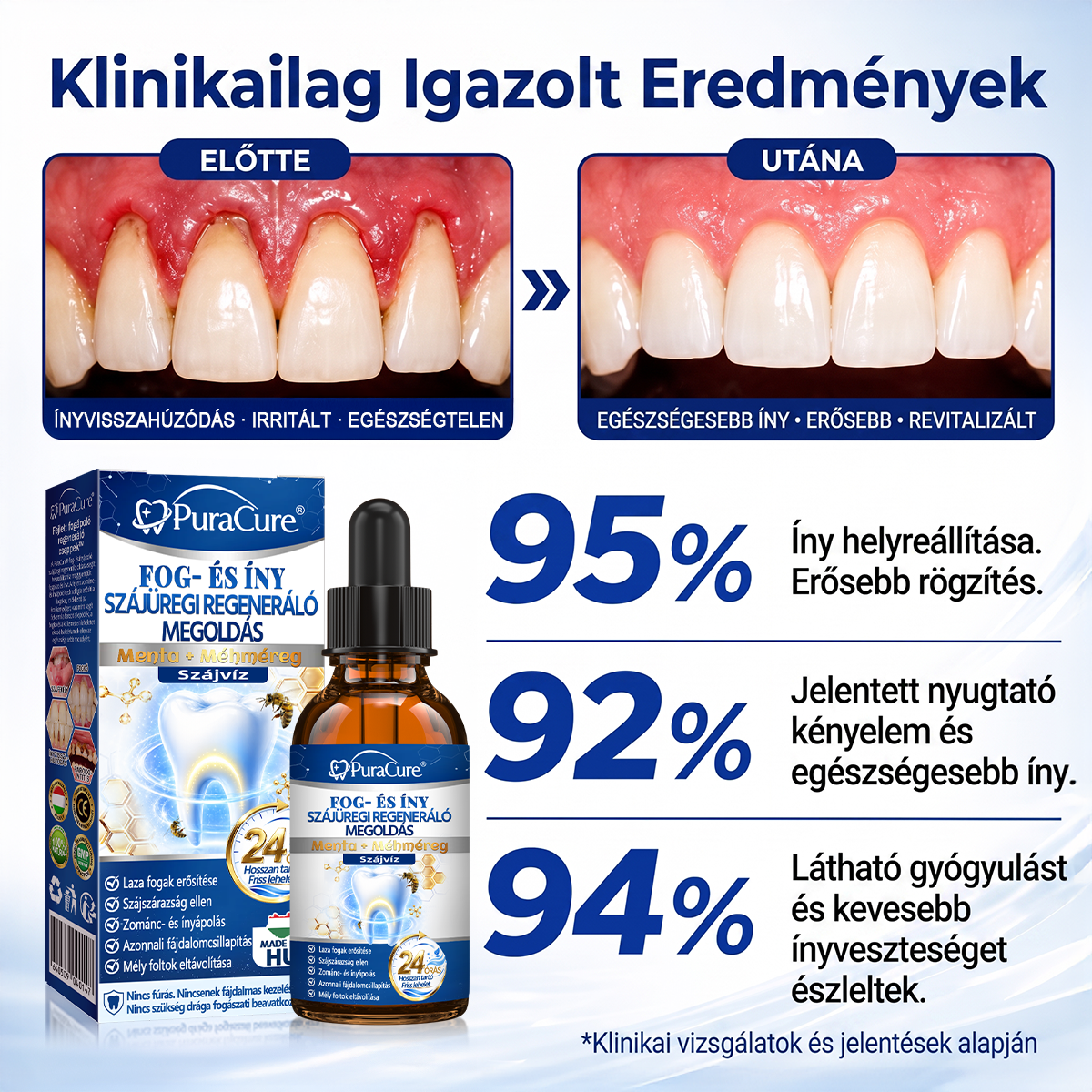 🦷𝐇𝐢𝐯𝐚𝐭𝐚𝐥𝐨𝐬 Á𝐫𝐮𝐡á𝐳 | 𝐏𝐮𝐫𝐚𝐂𝐮𝐫𝐞® 𝐅𝐨𝐠- é𝐬 Í𝐧𝐲 𝐒𝐳á𝐣ü𝐫𝐞𝐠𝐢 𝐑𝐞𝐠𝐞𝐧𝐞𝐫á𝐥ó 𝐎𝐥𝐝𝐚𝐭 | 𝐌é𝐡𝐦é𝐫𝐞𝐠-𝐩𝐞𝐩𝐭𝐢𝐝𝐞𝐤 × 𝐊𝐨𝐥𝐥𝐚𝐠é𝐧 × 𝐏𝐨𝐬𝐳𝐭𝐛𝐢𝐨𝐭𝐢𝐤𝐮𝐦𝐨𝐤 × 𝐁é𝐭𝐚-𝐠𝐥ü𝐤𝐚𝐧á𝐳 𝐞𝐫𝐞𝐣é𝐯𝐞𝐥 𝐚 𝐥𝐞𝐩𝐞𝐝é𝐤, 𝐟𝐨𝐠𝐤ő, 𝐟𝐨𝐠𝐟á𝐣á𝐬, 𝐫𝐨𝐬𝐬𝐳 𝐥𝐞𝐡𝐞𝐥𝐞𝐭 é𝐬 𝐠𝐲𝐞𝐧𝐠𝐞 𝐟𝐨𝐠𝐚𝐤 𝐞𝐥𝐥𝐞𝐧