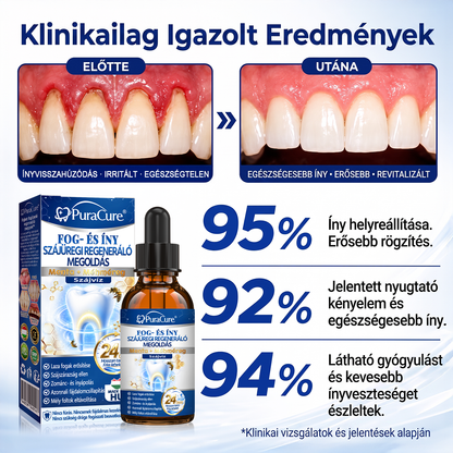 🦷𝐇𝐢𝐯𝐚𝐭𝐚𝐥𝐨𝐬 Á𝐫𝐮𝐡á𝐳 | 𝐏𝐮𝐫𝐚𝐂𝐮𝐫𝐞® 𝐅𝐨𝐠- é𝐬 Í𝐧𝐲 𝐒𝐳á𝐣ü𝐫𝐞𝐠𝐢 𝐑𝐞𝐠𝐞𝐧𝐞𝐫á𝐥ó 𝐎𝐥𝐝𝐚𝐭 | 𝐌é𝐡𝐦é𝐫𝐞𝐠-𝐩𝐞𝐩𝐭𝐢𝐝𝐞𝐤 × 𝐊𝐨𝐥𝐥𝐚𝐠é𝐧 × 𝐏𝐨𝐬𝐳𝐭𝐛𝐢𝐨𝐭𝐢𝐤𝐮𝐦𝐨𝐤 × 𝐁é𝐭𝐚-𝐠𝐥ü𝐤𝐚𝐧á𝐳 𝐞𝐫𝐞𝐣é𝐯𝐞𝐥 𝐚 𝐥𝐞𝐩𝐞𝐝é𝐤, 𝐟𝐨𝐠𝐤ő, 𝐟𝐨𝐠𝐟á𝐣á𝐬, 𝐫𝐨𝐬𝐬𝐳 𝐥𝐞𝐡𝐞𝐥𝐞𝐭 é𝐬 𝐠𝐲𝐞𝐧𝐠𝐞 𝐟𝐨𝐠𝐚𝐤 𝐞𝐥𝐥𝐞𝐧