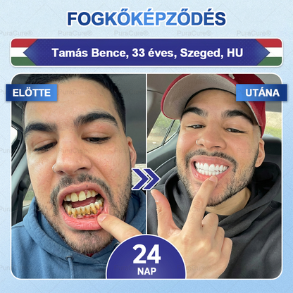 🦷PuraCure® többhatású fog- és ínyregeneráló szájvíz | Kollagén × posztbiotikumok × β-glükanáz