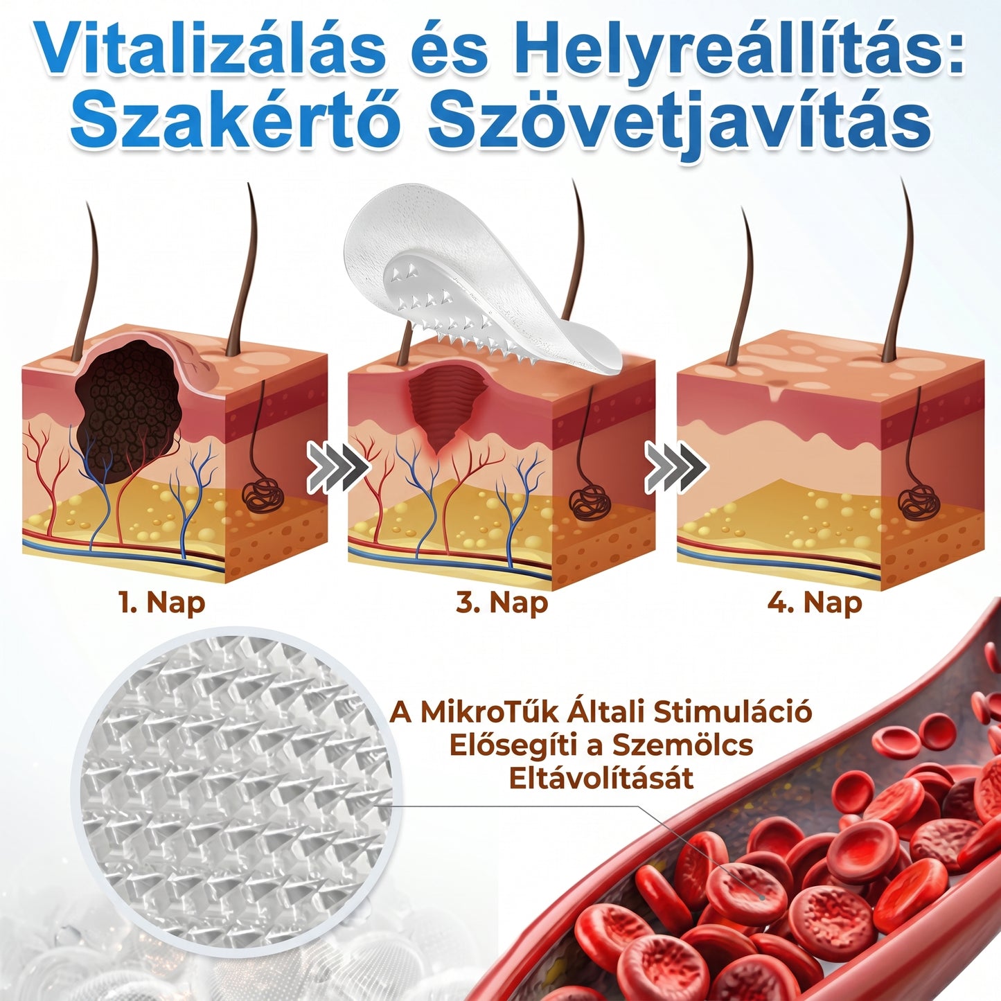 ✨ 2 az 1-ben mikrotűs és hidrokolloid tapasz🍀 | Kiálló anyajegyek, aknék, lapos szemölcsök és bőrnövedékek eltávolítására | Segít csökkenteni a ráncokat, hegeket és bőrhibákat | Láthatatlan tapasz az arcra és testre