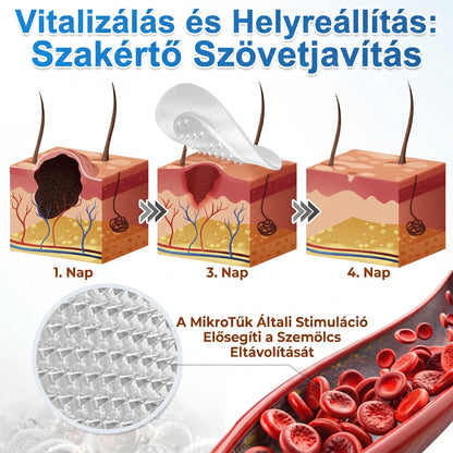✨ 2 az 1-ben mikrotűs és hidrokolloid tapasz🍀 | Kiálló anyajegyek, aknék, lapos szemölcsök és bőrnövedékek eltávolítására | Segít csökkenteni a ráncokat, hegeket és bőrhibákat | Láthatatlan tapasz az arcra és testre