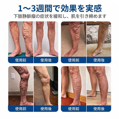 ✨🧑‍⚕️ Medistart® 下肢静脈瘤ケア用マイクロニードルパッチ ⚡ すぐに実感できる快適さ、長期的な効果