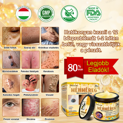 ✨FDA által jóváhagyva: 𝐍𝐎𝐑𝐔𝐈𝐎𝐍® 𝐌é𝐡𝐦é𝐫𝐞𝐠 𝐁ő𝐫𝐦𝐞𝐠ú𝐣í𝐭ó 𝐊𝐫é𝐦 — 🔥𝐊𝐨𝐫𝐥á𝐭𝐨𝐳𝐨𝐭𝐭 𝐢𝐝𝐞𝐢𝐠 𝟕𝟎% 𝐤𝐞𝐝𝐯𝐞𝐳𝐦é𝐧𝐲🔥