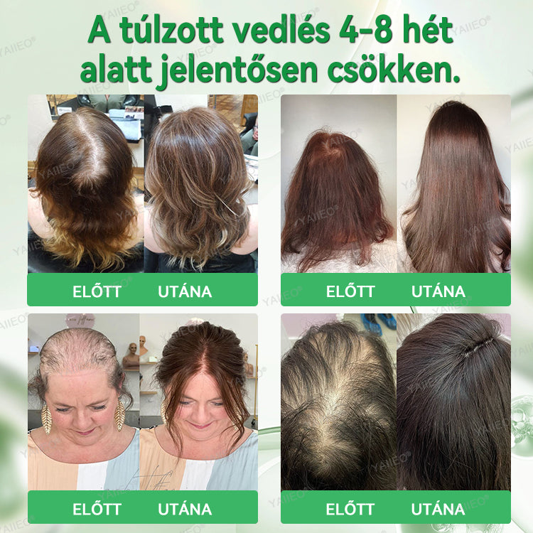 𝒀𝑨𝑰𝑰𝑬𝑶® 𝑯𝒂𝒋𝒔𝒆𝒓𝒌𝒆𝒏𝒕ő 𝑺𝒛é𝒓𝒖𝒎 – 𝑭á𝒋𝒅𝒂𝒍𝒐𝒎𝒎𝒆𝒏𝒕𝒆𝒔 𝑯𝒂𝒋á𝒑𝒐𝒍á𝒔