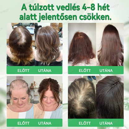 𝒀𝑨𝑰𝑰𝑬𝑶® 𝑯𝒂𝒋𝒔𝒆𝒓𝒌𝒆𝒏𝒕ő 𝑺𝒛é𝒓𝒖𝒎 – 𝑭á𝒋𝒅𝒂𝒍𝒐𝒎𝒎𝒆𝒏𝒕𝒆𝒔 𝑯𝒂𝒋á𝒑𝒐𝒍á𝒔