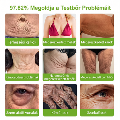 𝐌𝐞𝐝𝐢𝐬𝐭𝐚𝐫𝐭® ☘️☘️ 𝐏𝐃𝐑𝐍 Ö𝐫𝐞𝐠𝐞𝐝é𝐬𝐠á𝐭𝐥ó & 𝐂é𝐥𝐳𝐨𝐭𝐭 𝐅𝐨𝐥𝐭𝐦𝐞𝐠ú𝐣í𝐭ó 𝐒𝐭𝐢𝐟𝐭  （𝐒𝐞𝐠í𝐭 𝐤𝐢𝐬𝐢𝐦í𝐭𝐚𝐧𝐢 𝐚 𝐫á𝐧𝐜𝐨𝐤 𝐦𝐞𝐠𝐣𝐞𝐥𝐞𝐧é𝐬é𝐭, 𝐭á𝐦𝐨𝐠𝐚𝐭𝐣𝐚 𝐚 𝐟𝐞𝐬𝐳𝐞𝐬𝐞𝐛𝐛 𝐤𝐢𝐧é𝐳𝐞𝐭ű 𝐛ő𝐫𝐭, é𝐬 𝐣𝐚𝐯í𝐭𝐣𝐚 𝐚 𝐥á𝐭𝐡𝐚𝐭ó 𝐟𝐨𝐥𝐭𝐨𝐤 𝐦𝐞𝐠𝐣𝐞𝐥𝐞𝐧é𝐬é𝐭）