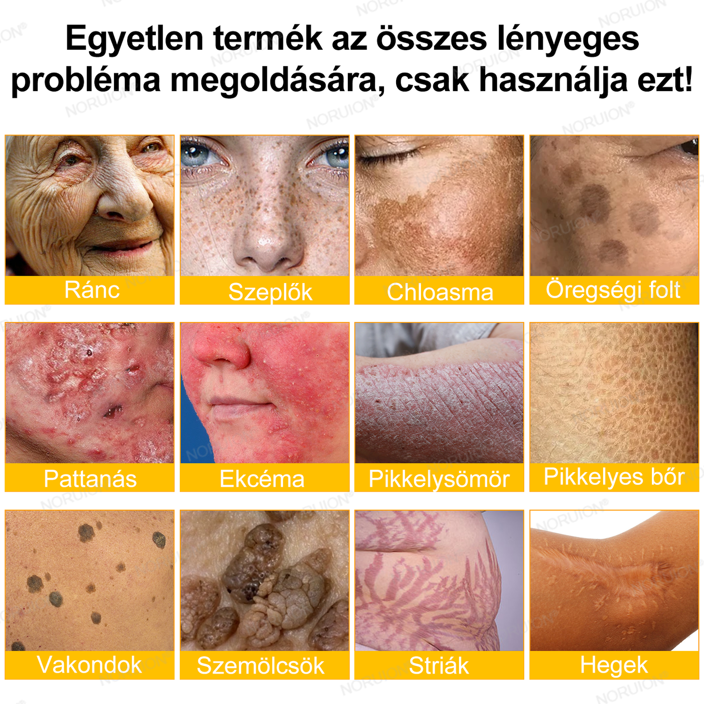 ✨FDA által jóváhagyva: 𝐍𝐎𝐑𝐔𝐈𝐎𝐍® 𝐌é𝐡𝐦é𝐫𝐞𝐠 𝐁ő𝐫𝐦𝐞𝐠ú𝐣í𝐭ó 𝐊𝐫é𝐦 — 🔥𝐊𝐨𝐫𝐥á𝐭𝐨𝐳𝐨𝐭𝐭 𝐢𝐝𝐞𝐢𝐠 𝟕𝟎% 𝐤𝐞𝐝𝐯𝐞𝐳𝐦é𝐧𝐲🔥