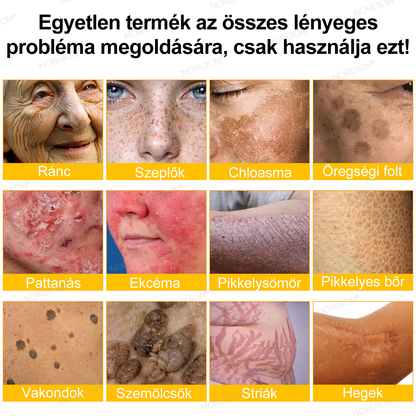 ✨FDA által jóváhagyva: 𝐍𝐎𝐑𝐔𝐈𝐎𝐍® 𝐌é𝐡𝐦é𝐫𝐞𝐠 𝐁ő𝐫𝐦𝐞𝐠ú𝐣í𝐭ó 𝐊𝐫é𝐦 — 🔥𝐊𝐨𝐫𝐥á𝐭𝐨𝐳𝐨𝐭𝐭 𝐢𝐝𝐞𝐢𝐠 𝟕𝟎% 𝐤𝐞𝐝𝐯𝐞𝐳𝐦é𝐧𝐲🔥