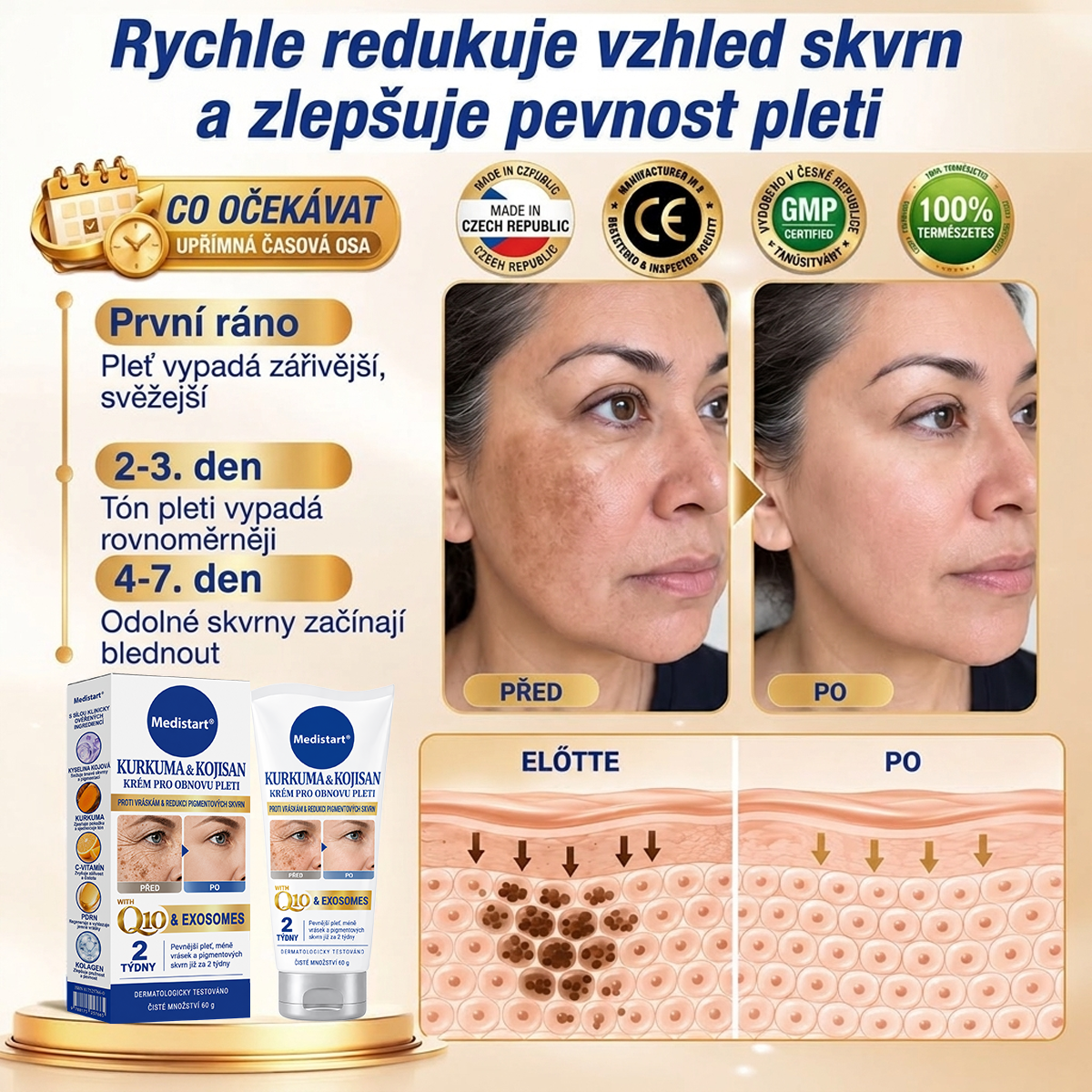 𝑶𝒇𝒊𝒄𝒊𝒂́𝒍𝒏𝒊́ 𝑶𝒃𝒄𝒉𝒐𝒅 | 𝐍𝐨𝐯𝐢𝐧𝐤𝐚! ✨ Medistart® 𝐊𝐮𝐫𝐤𝐮𝐦𝐚 × 𝐊𝐲𝐬𝐞𝐥𝐢𝐧𝐚 𝐤𝐨𝐣𝐨𝐯𝐚́ 𝐍𝐨𝐜̌𝐧𝐢́ 𝐨𝐦𝐥𝐚𝐳𝐮𝐣𝐢́𝐜𝐢́ 𝐤𝐫𝐞́𝐦 — 𝐙𝐞𝐬𝐯𝐞̌𝐭𝐥𝐢 𝐨𝐝𝐨𝐥𝐧𝐞́ 𝐭𝐦𝐚𝐯𝐞́ 𝐬𝐤𝐯𝐫𝐧𝐲 𝐚 𝐯𝐲𝐡𝐥𝐚𝐝̌ 𝐯𝐢𝐝𝐢𝐭𝐞𝐥𝐧𝐞́ 𝐯𝐫𝐚́𝐬𝐤𝐲 𝐛𝐞̌𝐡𝐞𝐦 𝐬𝐩𝐚́𝐧𝐤𝐮 🌙 ✅ 𝐉𝐞𝐝𝐞𝐧 𝐤𝐫𝐨𝐤 𝐤𝐚𝐳̌𝐝𝐨𝐮 𝐧𝐨𝐜 · 𝐕𝐢𝐝𝐢𝐭𝐞𝐥𝐧𝐚́ 𝐳𝐦𝐞̌𝐧𝐚 𝐳𝐚 𝟕 𝐧𝐨𝐜𝐢́ 💯