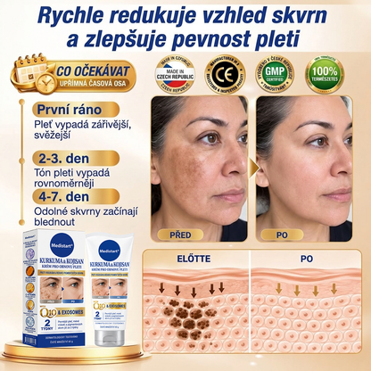 𝑶𝒇𝒊𝒄𝒊𝒂́𝒍𝒏𝒊́ 𝑶𝒃𝒄𝒉𝒐𝒅 | 𝐍𝐨𝐯𝐢𝐧𝐤𝐚! ✨ Medistart® 𝐊𝐮𝐫𝐤𝐮𝐦𝐚 × 𝐊𝐲𝐬𝐞𝐥𝐢𝐧𝐚 𝐤𝐨𝐣𝐨𝐯𝐚́ 𝐍𝐨𝐜̌𝐧𝐢́ 𝐨𝐦𝐥𝐚𝐳𝐮𝐣𝐢́𝐜𝐢́ 𝐤𝐫𝐞́𝐦 — 𝐙𝐞𝐬𝐯𝐞̌𝐭𝐥𝐢 𝐨𝐝𝐨𝐥𝐧𝐞́ 𝐭𝐦𝐚𝐯𝐞́ 𝐬𝐤𝐯𝐫𝐧𝐲 𝐚 𝐯𝐲𝐡𝐥𝐚𝐝̌ 𝐯𝐢𝐝𝐢𝐭𝐞𝐥𝐧𝐞́ 𝐯𝐫𝐚́𝐬𝐤𝐲 𝐛𝐞̌𝐡𝐞𝐦 𝐬𝐩𝐚́𝐧𝐤𝐮 🌙 ✅ 𝐉𝐞𝐝𝐞𝐧 𝐤𝐫𝐨𝐤 𝐤𝐚𝐳̌𝐝𝐨𝐮 𝐧𝐨𝐜 · 𝐕𝐢𝐝𝐢𝐭𝐞𝐥𝐧𝐚́ 𝐳𝐦𝐞̌𝐧𝐚 𝐳𝐚 𝟕 𝐧𝐨𝐜𝐢́ 💯