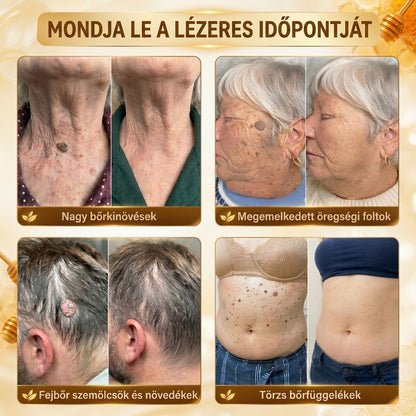 ✨PuraCure® TÖBBFÉLE BŐRPROBLÉMÁRA HATÓ MÉHMÉREG MIKROTŰS BŐRREGENERÁLÓ TAPASZOK