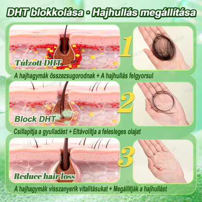 𝒀𝑨𝑰𝑰𝑬𝑶® 𝑯𝒂𝒋𝒔𝒆𝒓𝒌𝒆𝒏𝒕ő 𝑺𝒛é𝒓𝒖𝒎 – 𝑭á𝒋𝒅𝒂𝒍𝒐𝒎𝒎𝒆𝒏𝒕𝒆𝒔 𝑯𝒂𝒋á𝒑𝒐𝒍á𝒔