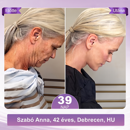 PuraCure® PDRN Multi-Peptid Masszírozó Testgörgős Krém – Öregedésgátlás, hidratálás, bőrfeszesítő és emelő hatás bőrjavítás, egyenletes bőrtónus, akne sötét foltok kezelése, szemölcsök és anyajegyek eltávolítása, valamint pikkelysömör enyhítése.