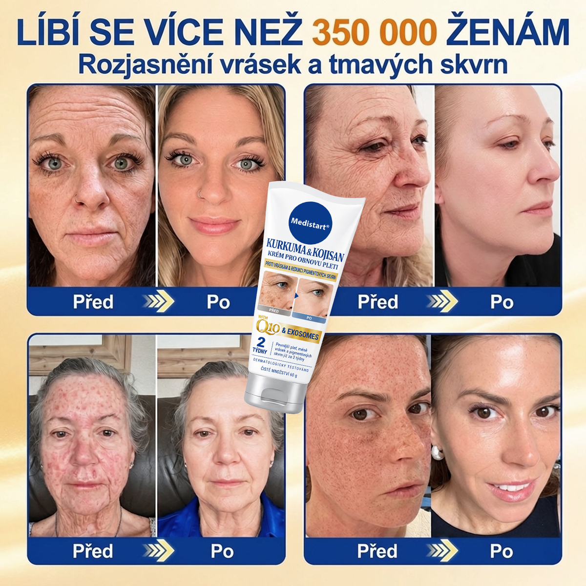 𝑶𝒇𝒊𝒄𝒊𝒂́𝒍𝒏𝒊́ 𝑶𝒃𝒄𝒉𝒐𝒅 | 𝐍𝐨𝐯𝐢𝐧𝐤𝐚! ✨ Medistart® 𝐊𝐮𝐫𝐤𝐮𝐦𝐚 × 𝐊𝐲𝐬𝐞𝐥𝐢𝐧𝐚 𝐤𝐨𝐣𝐨𝐯𝐚́ 𝐍𝐨𝐜̌𝐧𝐢́ 𝐨𝐦𝐥𝐚𝐳𝐮𝐣𝐢́𝐜𝐢́ 𝐤𝐫𝐞́𝐦 — 𝐙𝐞𝐬𝐯𝐞̌𝐭𝐥𝐢 𝐨𝐝𝐨𝐥𝐧𝐞́ 𝐭𝐦𝐚𝐯𝐞́ 𝐬𝐤𝐯𝐫𝐧𝐲 𝐚 𝐯𝐲𝐡𝐥𝐚𝐝̌ 𝐯𝐢𝐝𝐢𝐭𝐞𝐥𝐧𝐞́ 𝐯𝐫𝐚́𝐬𝐤𝐲 𝐛𝐞̌𝐡𝐞𝐦 𝐬𝐩𝐚́𝐧𝐤𝐮 🌙 ✅ 𝐉𝐞𝐝𝐞𝐧 𝐤𝐫𝐨𝐤 𝐤𝐚𝐳̌𝐝𝐨𝐮 𝐧𝐨𝐜 · 𝐕𝐢𝐝𝐢𝐭𝐞𝐥𝐧𝐚́ 𝐳𝐦𝐞̌𝐧𝐚 𝐳𝐚 𝟕 𝐧𝐨𝐜𝐢́ 💯
