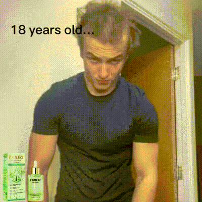 𝒀𝑨𝑰𝑰𝑬𝑶® 𝑯𝒂𝒋𝒔𝒆𝒓𝒌𝒆𝒏𝒕ő 𝑺𝒛é𝒓𝒖𝒎 – 𝑭á𝒋𝒅𝒂𝒍𝒐𝒎𝒎𝒆𝒏𝒕𝒆𝒔 𝑯𝒂𝒋á𝒑𝒐𝒍á𝒔