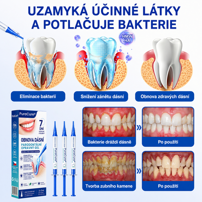 𝐜𝐳) 🦷 𝐏𝐮𝐫𝐚𝐂𝐮𝐫𝐞®  𝐎𝐛𝐧𝐨𝐯𝐚 𝐝á𝐬𝐧í 𝐩𝐚𝐫𝐨𝐝𝐨𝐧𝐭á𝐥𝐧í 𝐨𝐩𝐫𝐚𝐯𝐧ý 𝐠𝐞𝐥