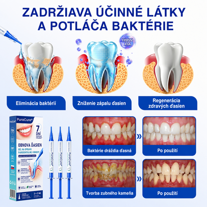 𝒔𝒌)𝑷𝒖𝒓𝒂𝑪𝒖𝒓𝒆® 👨‍⚕️🦷𝑶𝑩𝑵𝑶𝑽𝑨 Ď𝑨𝑺𝑰𝑬𝑵 𝑷𝒂𝒓𝒐𝒅𝒐𝒏𝒕á𝒍𝒏𝒚 𝒐𝒑𝒓𝒂𝒗𝒏ý 𝒈é𝒍🥬