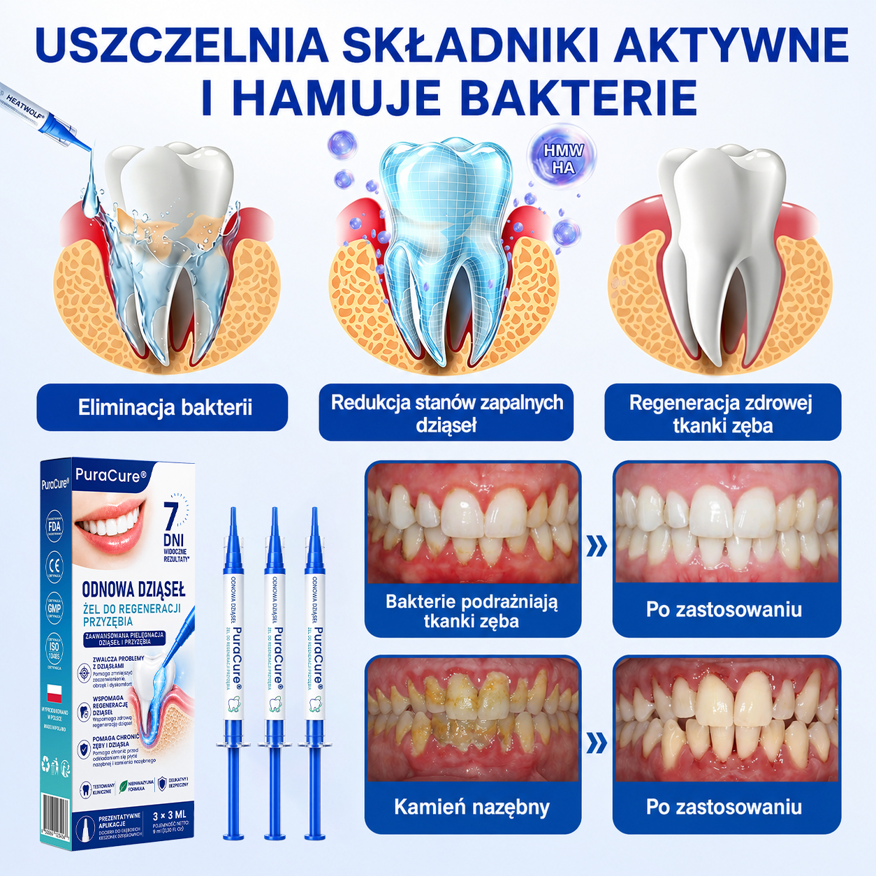 🇵🇱👨‍⚕️✅🦷𝗣𝘂𝗿𝗮𝗖𝘂𝗿𝗲® 𝗢𝗗𝗡𝗢𝗪𝗔 𝗗𝗭𝗜Ą𝗦𝗘Ł Ż𝗲𝗹 𝗻𝗮𝗽𝗿𝗮𝘄𝗰𝘇𝘆 𝗽𝗿𝘇𝘆 𝗽𝗮𝗿𝗮𝗱𝗼𝗻𝘁𝗼𝘇𝗶𝗲🍔