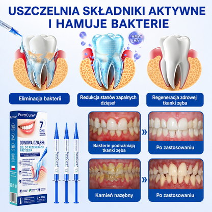 🇵🇱👨‍⚕️✅🦷𝗣𝘂𝗿𝗮𝗖𝘂𝗿𝗲® 𝗢𝗗𝗡𝗢𝗪𝗔 𝗗𝗭𝗜Ą𝗦𝗘Ł Ż𝗲𝗹 𝗻𝗮𝗽𝗿𝗮𝘄𝗰𝘇𝘆 𝗽𝗿𝘇𝘆 𝗽𝗮𝗿𝗮𝗱𝗼𝗻𝘁𝗼𝘇𝗶𝗲🍔