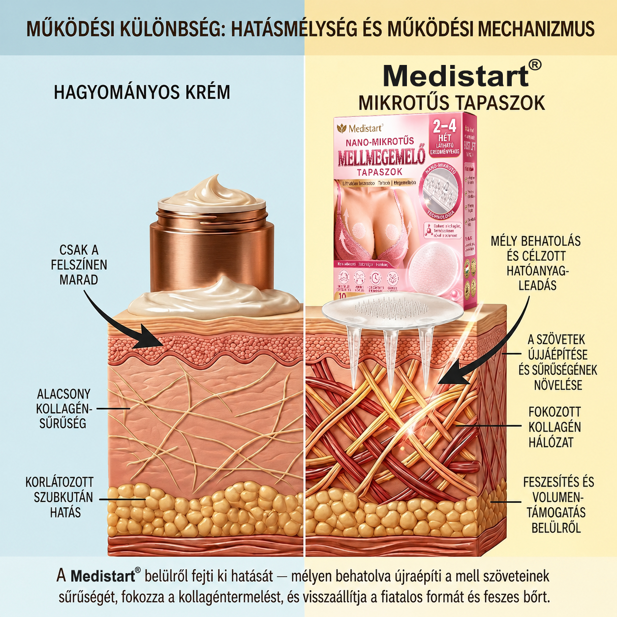 🚩Medistart®🔥🧉Célzott mellnagyobbításra szolgáló, fejlett nanomikrotűs tapasz