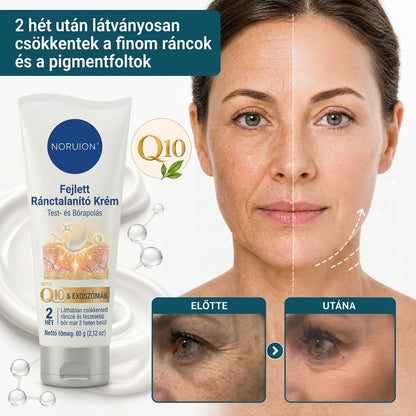✨ NORUION® Q10 + növényi nano-exoszóma fejlett ránctalanító krém