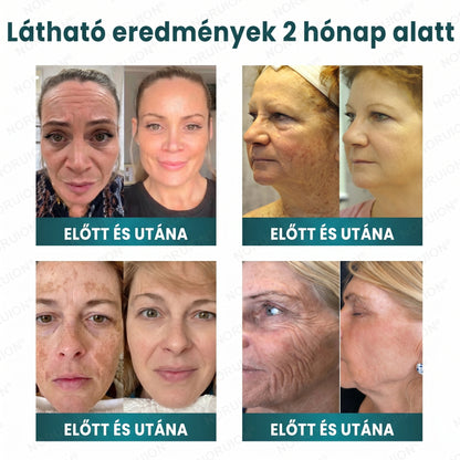✨ NORUION® Q10 + növényi nano-exoszóma fejlett ránctalanító krém