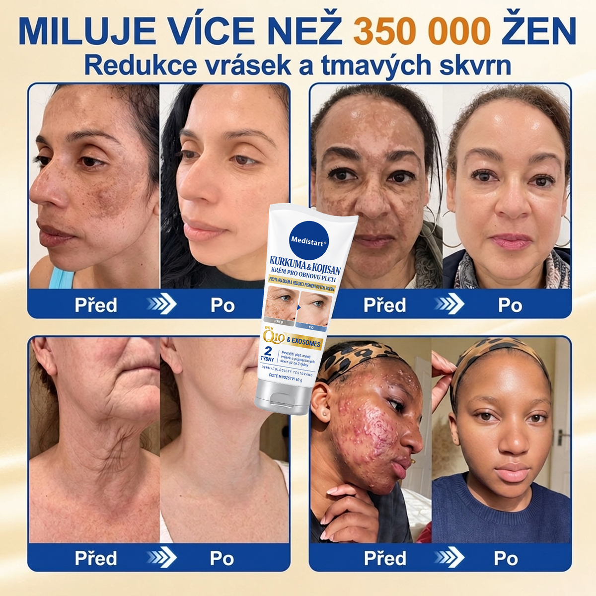𝑶𝒇𝒊𝒄𝒊𝒂́𝒍𝒏𝒊́ 𝑶𝒃𝒄𝒉𝒐𝒅 | 𝐍𝐨𝐯𝐢𝐧𝐤𝐚! ✨ Medistart® 𝐊𝐮𝐫𝐤𝐮𝐦𝐚 × 𝐊𝐲𝐬𝐞𝐥𝐢𝐧𝐚 𝐤𝐨𝐣𝐨𝐯𝐚́ 𝐍𝐨𝐜̌𝐧𝐢́ 𝐨𝐦𝐥𝐚𝐳𝐮𝐣𝐢́𝐜𝐢́ 𝐤𝐫𝐞́𝐦 — 𝐙𝐞𝐬𝐯𝐞̌𝐭𝐥𝐢 𝐨𝐝𝐨𝐥𝐧𝐞́ 𝐭𝐦𝐚𝐯𝐞́ 𝐬𝐤𝐯𝐫𝐧𝐲 𝐚 𝐯𝐲𝐡𝐥𝐚𝐝̌ 𝐯𝐢𝐝𝐢𝐭𝐞𝐥𝐧𝐞́ 𝐯𝐫𝐚́𝐬𝐤𝐲 𝐛𝐞̌𝐡𝐞𝐦 𝐬𝐩𝐚́𝐧𝐤𝐮 🌙 ✅ 𝐉𝐞𝐝𝐞𝐧 𝐤𝐫𝐨𝐤 𝐤𝐚𝐳̌𝐝𝐨𝐮 𝐧𝐨𝐜 · 𝐕𝐢𝐝𝐢𝐭𝐞𝐥𝐧𝐚́ 𝐳𝐦𝐞̌𝐧𝐚 𝐳𝐚 𝟕 𝐧𝐨𝐜𝐢́ 💯