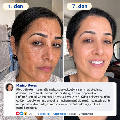 𝑶𝒇𝒊𝒄𝒊𝒂́𝒍𝒏𝒊́ 𝑶𝒃𝒄𝒉𝒐𝒅 | 𝐍𝐨𝐯𝐢𝐧𝐤𝐚! ✨ Medistart® 𝐊𝐮𝐫𝐤𝐮𝐦𝐚 × 𝐊𝐲𝐬𝐞𝐥𝐢𝐧𝐚 𝐤𝐨𝐣𝐨𝐯𝐚́ 𝐍𝐨𝐜̌𝐧𝐢́ 𝐨𝐦𝐥𝐚𝐳𝐮𝐣𝐢́𝐜𝐢́ 𝐤𝐫𝐞́𝐦 — 𝐙𝐞𝐬𝐯𝐞̌𝐭𝐥𝐢 𝐨𝐝𝐨𝐥𝐧𝐞́ 𝐭𝐦𝐚𝐯𝐞́ 𝐬𝐤𝐯𝐫𝐧𝐲 𝐚 𝐯𝐲𝐡𝐥𝐚𝐝̌ 𝐯𝐢𝐝𝐢𝐭𝐞𝐥𝐧𝐞́ 𝐯𝐫𝐚́𝐬𝐤𝐲 𝐛𝐞̌𝐡𝐞𝐦 𝐬𝐩𝐚́𝐧𝐤𝐮 🌙 ✅ 𝐉𝐞𝐝𝐞𝐧 𝐤𝐫𝐨𝐤 𝐤𝐚𝐳̌𝐝𝐨𝐮 𝐧𝐨𝐜 · 𝐕𝐢𝐝𝐢𝐭𝐞𝐥𝐧𝐚́ 𝐳𝐦𝐞̌𝐧𝐚 𝐳𝐚 𝟕 𝐧𝐨𝐜𝐢́ 💯