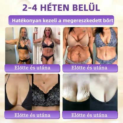 Magyarországról szállítva ✨ NORUION® Biotin 10 az 1-ben bőrmegújító krém
