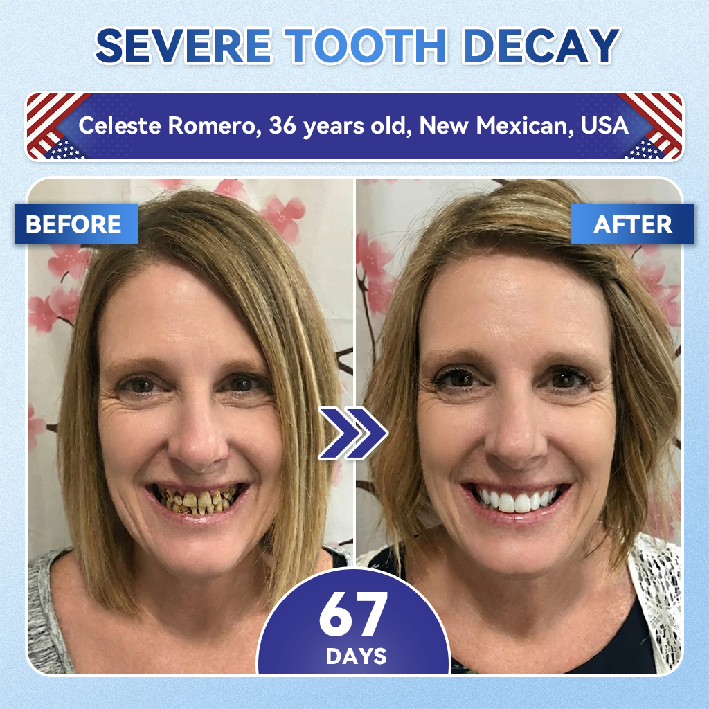 🦷PuraCure® Multi-Action Tooth & Gum Repair Mouthwash  | Collagen × Postbiotics × β-Glucanase
