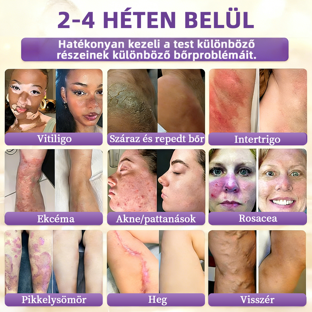 Magyarországról szállítva ✨ NORUION® Biotin 10 az 1-ben bőrmegújító krém