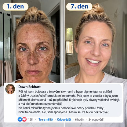 𝑶𝒇𝒊𝒄𝒊𝒂́𝒍𝒏𝒊́ 𝑶𝒃𝒄𝒉𝒐𝒅 | 𝐍𝐨𝐯𝐢𝐧𝐤𝐚! ✨ Medistart® 𝐊𝐮𝐫𝐤𝐮𝐦𝐚 × 𝐊𝐲𝐬𝐞𝐥𝐢𝐧𝐚 𝐤𝐨𝐣𝐨𝐯𝐚́ 𝐍𝐨𝐜̌𝐧𝐢́ 𝐨𝐦𝐥𝐚𝐳𝐮𝐣𝐢́𝐜𝐢́ 𝐤𝐫𝐞́𝐦 — 𝐙𝐞𝐬𝐯𝐞̌𝐭𝐥𝐢 𝐨𝐝𝐨𝐥𝐧𝐞́ 𝐭𝐦𝐚𝐯𝐞́ 𝐬𝐤𝐯𝐫𝐧𝐲 𝐚 𝐯𝐲𝐡𝐥𝐚𝐝̌ 𝐯𝐢𝐝𝐢𝐭𝐞𝐥𝐧𝐞́ 𝐯𝐫𝐚́𝐬𝐤𝐲 𝐛𝐞̌𝐡𝐞𝐦 𝐬𝐩𝐚́𝐧𝐤𝐮 🌙 ✅ 𝐉𝐞𝐝𝐞𝐧 𝐤𝐫𝐨𝐤 𝐤𝐚𝐳̌𝐝𝐨𝐮 𝐧𝐨𝐜 · 𝐕𝐢𝐝𝐢𝐭𝐞𝐥𝐧𝐚́ 𝐳𝐦𝐞̌𝐧𝐚 𝐳𝐚 𝟕 𝐧𝐨𝐜𝐢́ 💯