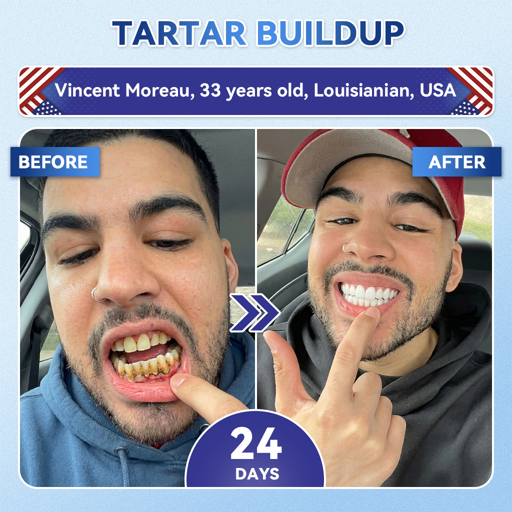 🦷PuraCure® Multi-Action Tooth & Gum Repair Mouthwash  | Collagen × Postbiotics × β-Glucanase