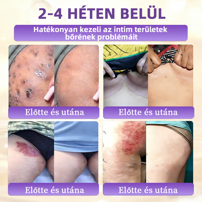 Magyarországról szállítva ✨ NORUION® Biotin 10 az 1-ben bőrmegújító krém
