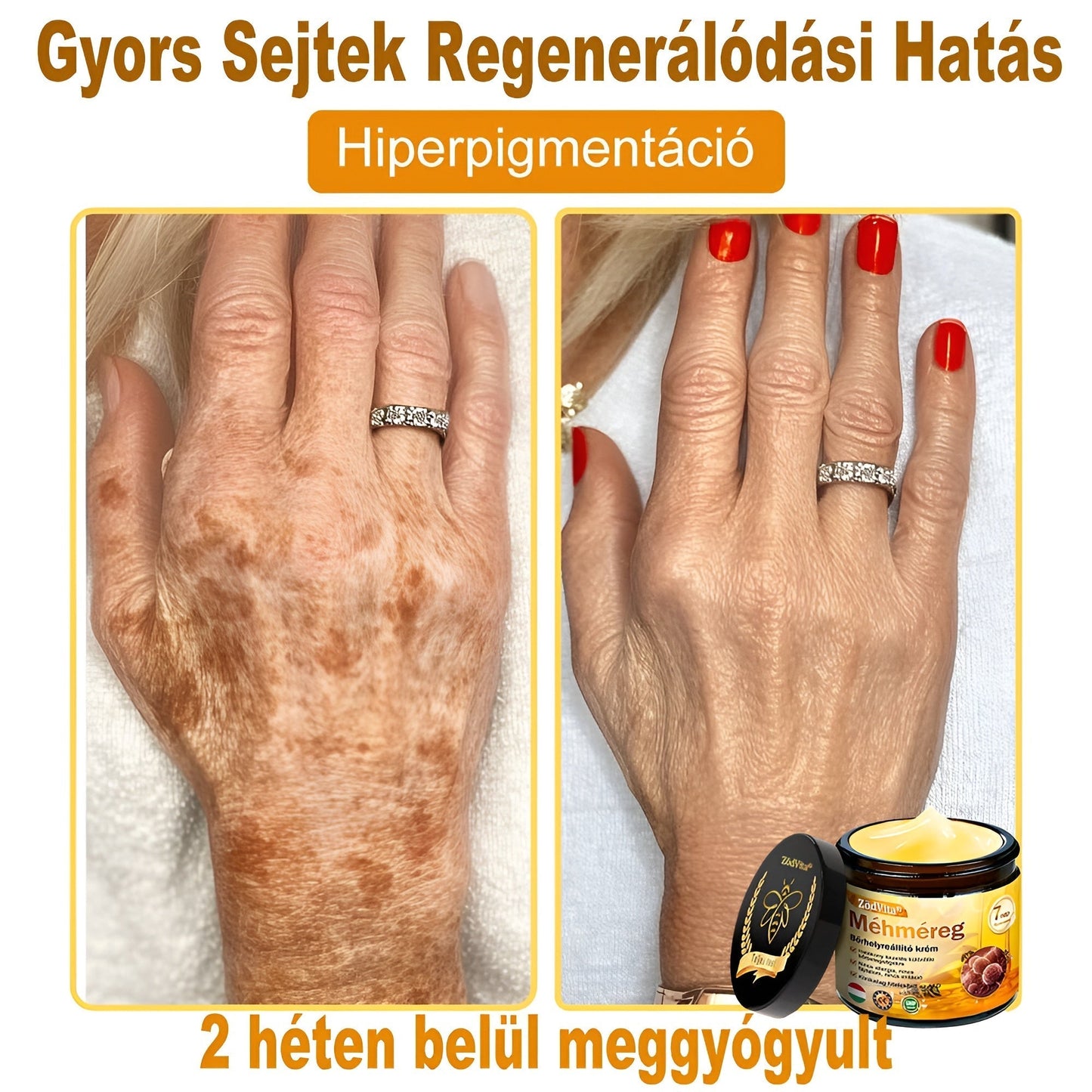 📦 Bőrgyógyász ajánlása ✨ ZödVita® Méhméreg Bőr Helyreállító Krém 🔥 Magyar fejlesztés, magyarországi gyártás és szállítás