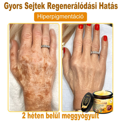 📦 Bőrgyógyász ajánlása ✨ ZödVita® Méhméreg Bőr Helyreállító Krém 🔥 Magyar fejlesztés, magyarországi gyártás és szállítás