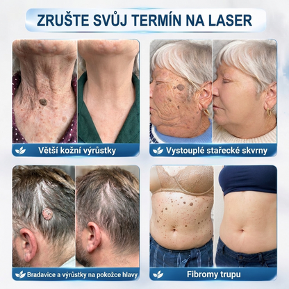 PuraCure® MIKROJEHLIČKOVÉ NÁPLASTI PRO ODSTRANĚNÍ KOŽNÍCH VÝRŮSTKŮ —— 7DENNÍ CÍLENÁ PÉČE PRO KOŽNÍ VÝRŮSTKY, BRADAVICE A VYSTOUPLÉ NEDOKONALOSTI POKOŽKY