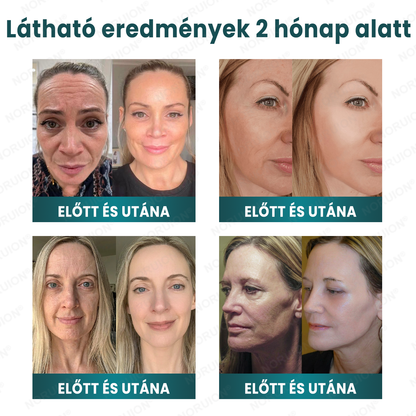 ✨ NORUION® Q10 + növényi nano-exoszóma fejlett ránctalanító krém